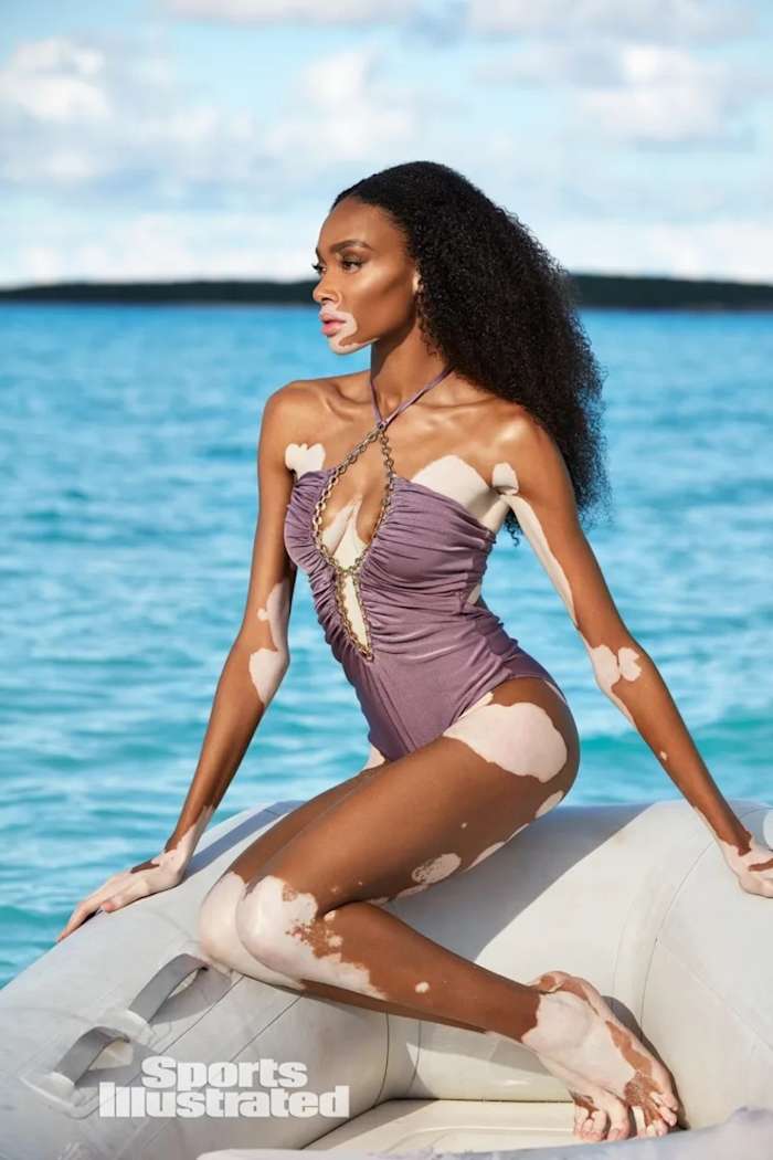 Winnie Harlow looks off into the distance, wearing a dusty lilac one-piece with gold ring detailing.